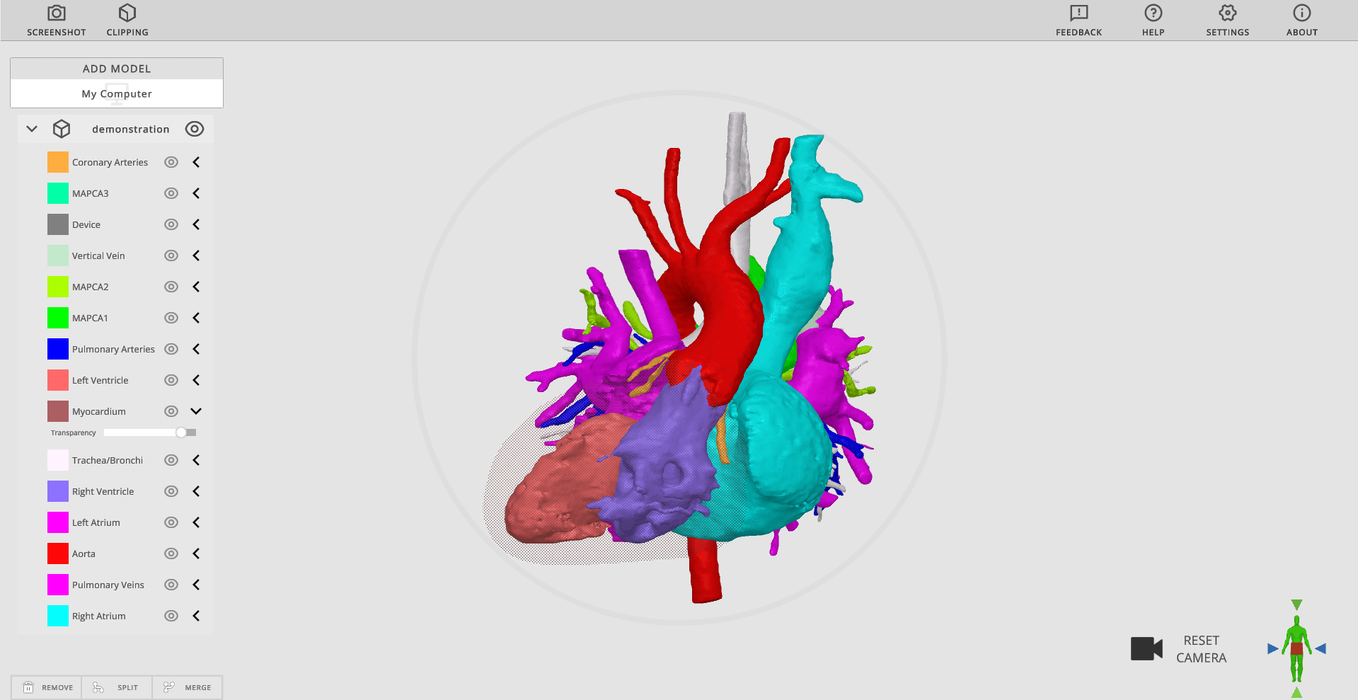Rady’s Children’s Hospital screenshot of heart